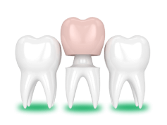 TRK-dental: восстановим ваши зубы