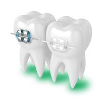 TRK-dental: сделаем ровные зубы и исправим прикус