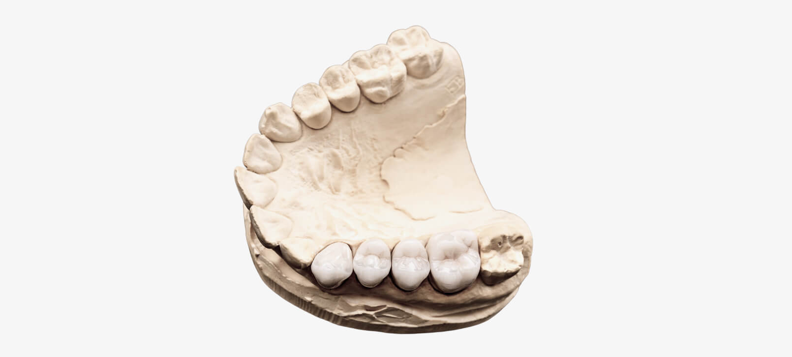 TRK-dental: протезы и коронки