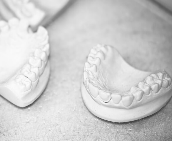 TRK-dental: Зубные протезы
