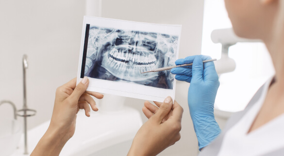 TRK-dental: лечение кисты зуба